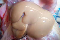 perfusion