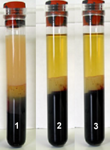 blood samples