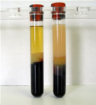 chylomicrons